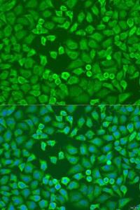 Immunofluorescence analysis of U2OS cells using Anti-eIF3A Antibody (A12654) at a dilution of 1:100. DAPI was used to stain the cell nuclei (blue)