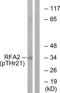 Western blot analysis of lysates from HeLa cells treated with Adriamycin 0.5ug/ml 24h using Anti-RFA2 (phospho Thr21) Antibody. The right hand lane represents a negative control, where the antibody is blocked by the immunising peptide