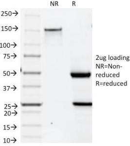 SDS-PAGE analysis of Anti-Cytokeratin 19 Antibody [BA17] under non-reduced and reduced conditions; showing intact IgG and intact heavy and light chains, respectively. SDS-PAGE analysis confirms the integrity and purity of the antibody