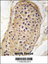 Anti-RICTOR Rabbit Polyclonal Antibody