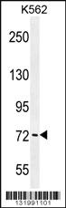 Anti-PAK6 Rabbit Polyclonal Antibody