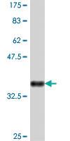 Anti-ROM1 Mouse Polyclonal Antibody