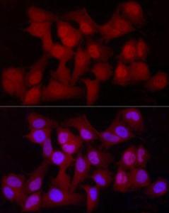 Immunofluorescence analysis of HeLa cells using Anti-YAP1 Antibody [ARC53477] (A308258) at a dilution of 1:100 (40x lens). DAPI was used to stain the cell nuclei (blue)