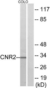 Western blot analysis of lysates from COLO205 cells using Anti-CNR2 Antibody. The right hand lane represents a negative control, where the antibody is blocked by the immunising peptide