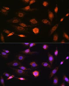 Immunofluorescence analysis of NIH-3T3 cells using Anti-CAMKIV Antibody [ARC1506] (A305710) at a dilution of 1:100 (40x lens) DAPI was used to stain the cell nuclei (blue)