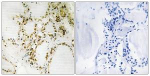 Antibody anti-P300 phospho SER89 100 µg