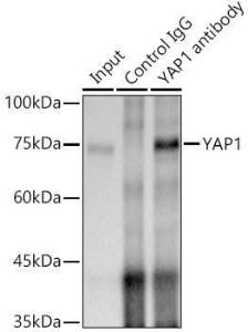 Immunoprecipitation analysis of 300 µg extracts of A-549 cells using 3 µg of Anti-YAP1 Antibody [ARC53477] (A308258). This Western blot was performed on the immunoprecipitate using Anti-YAP1 Antibody [ARC53477] (A308258) at a dilution of 1:500