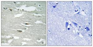 Immunohistochemical analysis of paraffin-embedded human brain using Anti-ILK (phospho Ser246) Antibody The right hand panel represents a negative control, where the antibody was pre-incubated with the immunising peptide