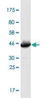 Anti-MAP3K5 Mouse Monoclonal Antibody [clone: X1]