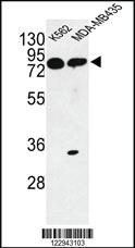 Anti-PRKAA1 Rabbit Polyclonal Antibody