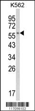 Anti-CYP8B1 Rabbit Polyclonal Antibody