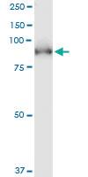 Anti-PDE5A Mouse Monoclonal Antibody [clone: 1F11]