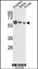 Anti-IGFALS Rabbit Polyclonal Antibody