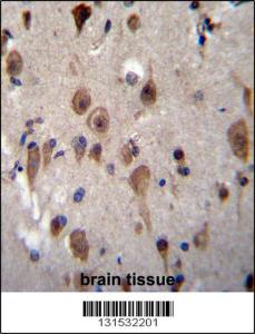 Anti-LRRC28 Rabbit Polyclonal Antibody (HRP (Horseradish Peroxidase))