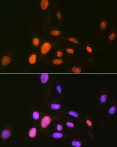 Immunofluorescence analysis of U-2 OS cells using Anti-CAMKIV Antibody [ARC1506] (A305710) at a dilution of 1:100 (40x lens) DAPI was used to stain the cell nuclei (blue)