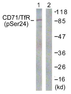 Western blot analysis of lysates from 293 cells treated with PMA 125ng/ml 30' using Anti-CD71 (phospho Ser24) Antibody The right hand lane represents a negative control, where the antibody is blocked by the immunising peptide