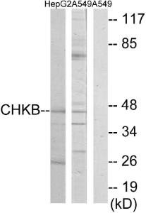 Western blot analysis of lysates from HepG2 and A549 cells using Anti-CHKB Antibody. The right hand lane represents a negative control, where the antibody is blocked by the immunising peptide