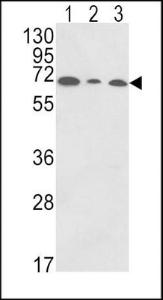 Anti-PIGR Rabbit Polyclonal Antibody (AP (Alkaline Phosphatase))