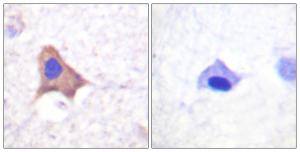 Immunohistochemical analysis of paraffin-embedded human brain using Anti-CD71 (phospho Ser24) Antibody The right hand panel represents a negative control, where the antibody was pre-incubated with the immunising peptide