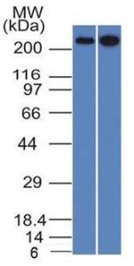 Anti-beta III Spectrin Mouse Monoclonal Antibody [clone: SPTBN2/1582]