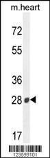 Anti-B3GAT2 Rabbit Polyclonal Antibody (HRP (Horseradish Peroxidase))