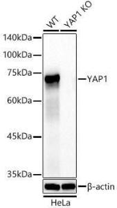 Western blot analysis of extracts from wild type(WT) and YAP1 knockout (KO) HeLa cells, using Anti-YAP1 Antibody [ARC53477] (A308258) at 1:4000 dilution