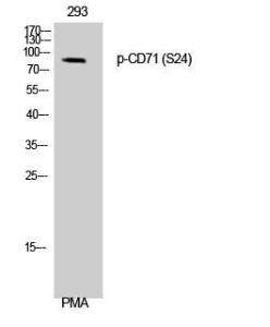 Western blot analysis of 293 cells using Anti-CD71 (phospho Ser24) Antibody