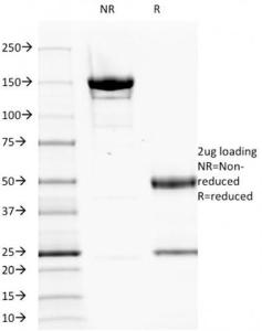 SDS-PAGE analysis of Anti-EGFR Antibody [GFR1195] under non-reduced and reduced conditions; showing intact IgG and intact heavy and light chains, respectively. SDS-PAGE analysis confirms the integrity and purity of the antibody.