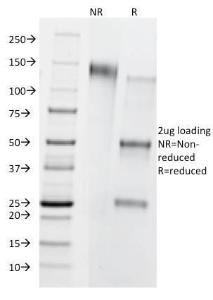 SDS-PAGE analysis of Anti-CD8B Antibody [BU88] under non-reduced and reduced conditions; showing intact IgG and intact heavy and light chains, respectively. SDS-PAGE analysis confirms the integrity and purity of the antibody