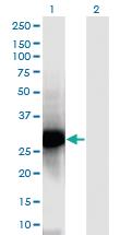 Anti-NPM2 Mouse Monoclonal Antibody [clone: 5E9]