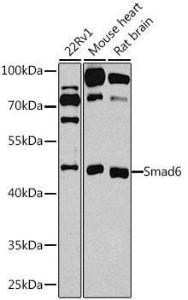 Western blot analysis of extracts of various cell lines, using Anti-SMAD6 Antibody (A12656) at 1:1000 dilution. The secondary Antibody was Goat Anti-Rabbit IgG H&L Antibody (HRP) at 1:10000 dilution. Lysates/proteins were present at 25 µg per lane