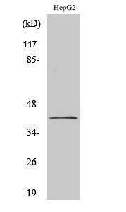 Western blot analysis of various cells using Anti-CHKB Antibody