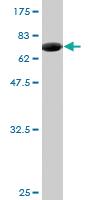 Anti-ZNF70 Mouse Monoclonal Antibody [clone: 3F8]