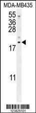 Anti-LYRM4 Rabbit Polyclonal Antibody