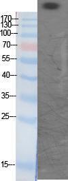 Western blot analysis of various cells using Anti-CBP (acetyl Lys1535) Antibody