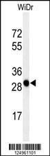 Anti-PAQR3 Rabbit Polyclonal Antibody (AP (Alkaline Phosphatase))