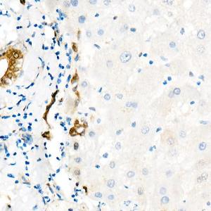 Immunohistochemistry analysis of paraffin-embedded human liver (negative control sample) using Anti-YAP1 Antibody [ARC53477] (A308258) at a dilution of 1:200(40x lens)