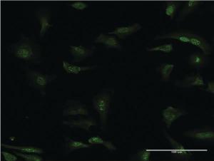 Anti-PDE5A Mouse Monoclonal Antibody [clone: 1F11]