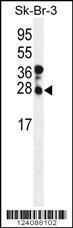 Anti-CHMP4B Rabbit Polyclonal Antibody (APC (Allophycocyanin))