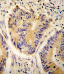 Anti-ADH4 Rabbit Polyclonal Antibody