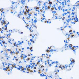 Immunohistochemistry analysis of paraffin-embedded rat lung using Anti-EEA1 Antibody (A12659) at a dilution of 1:100 (40x lens). Perform microwave antigen retrieval with 10 mM PBS buffer pH 7.2 before commencing with IHC staining protocol.