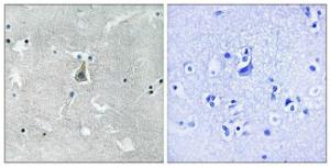 Immunohistochemical analysis of paraffin-embedded human brain using Anti-Bax (phospho Ser184) Antibody. The right hand panel represents a negative control, where the antibody was pre-incubated with the immunising peptide