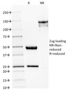 Anti-beta III Spectrin Mouse Monoclonal Antibody [clone: SPTBN2/1582]