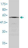 Anti-RAD51 Mouse Polyclonal Antibody