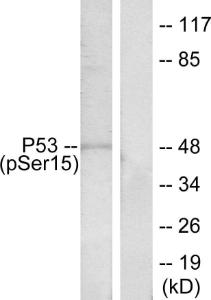 Western blot analysis of lysates from HeLa cells treated with HU using Anti-p53 (phospho Ser15) Antibody. The right hand lane represents a negative control, where the antibody is blocked by the immunising peptide