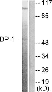 Western blot analysis of lysates from HeLa cells using Anti-DP-1 Antibody. The right hand lane represents a negative control, where the antibody is blocked by the immunising peptide