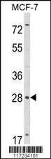 Anti-RASL11B Rabbit Polyclonal Antibody