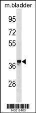 Anti-CRYM Rabbit Polyclonal Antibody