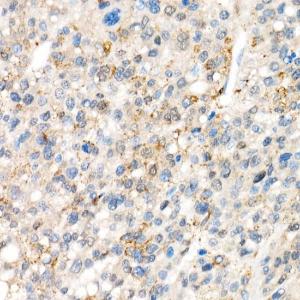 Immunohistochemistry analysis of paraffin-embedded human liver (negative control sample) using Anti-YAP1 Antibody [ARC53477] (A308258) at a dilution of 1:200(40x lens)