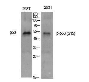 Western blot analysis of various cells using Anti-p53 (phospho Ser15) Antibody